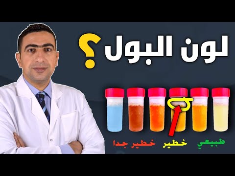 لون البول يدل على حالتك الصحية احذر من اعراض حصى الكلي والتهاب الكبد