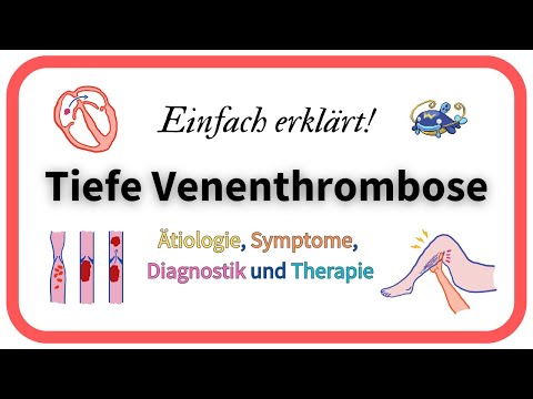 Deep vein thrombosis – causes, symptoms, diagnosis and treatment | Simply explained!