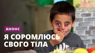 Премьера нового сезона – Я стесняюсь своего тела 2020. Смотрите скоро!