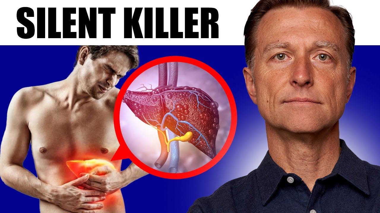 Silent Killer: Identifying Liver Cirrhosis Before It's Too Late