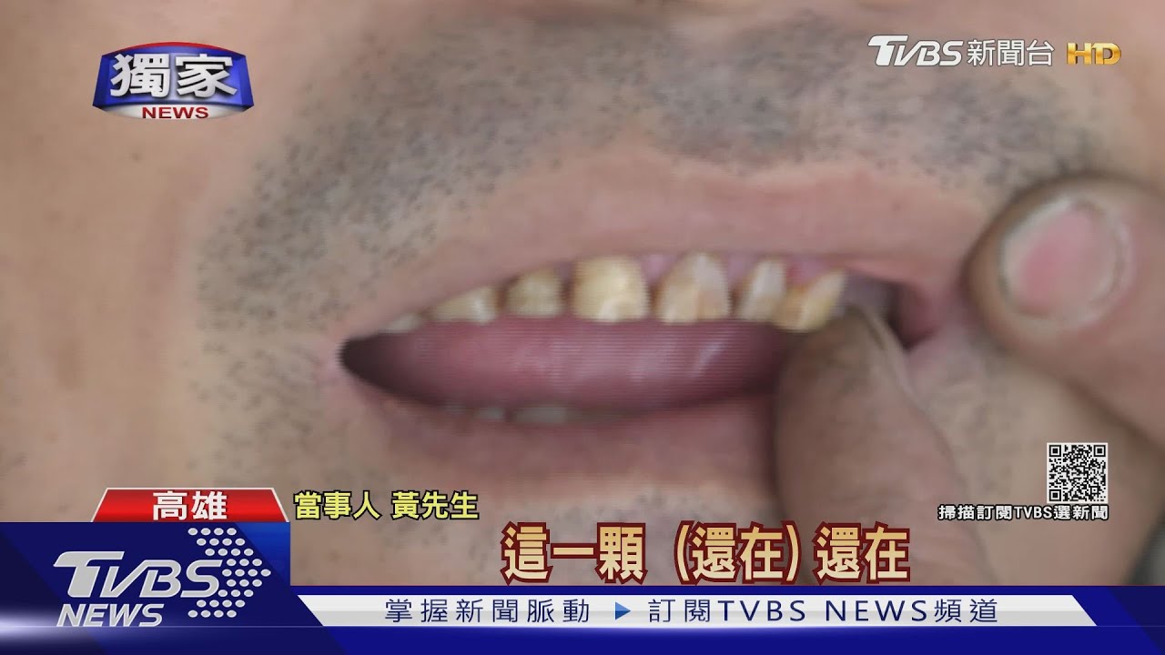 拔牙打麻醉嘸用!控牙醫硬拔 患者:比身中7刀還要痛