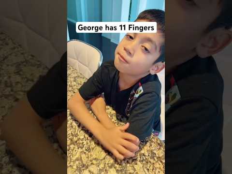 We Found Out Our Son Has an Extra Finger!! #short #shorts #shortsvideo
