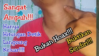 Download lagu Just Do This! Fish Bones Come Out in Seconds!! The Latest Way to Remove Fish from Your Throat mp3