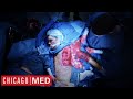 Patient Suffers From A Flesh Eating Disorder Chicago Med