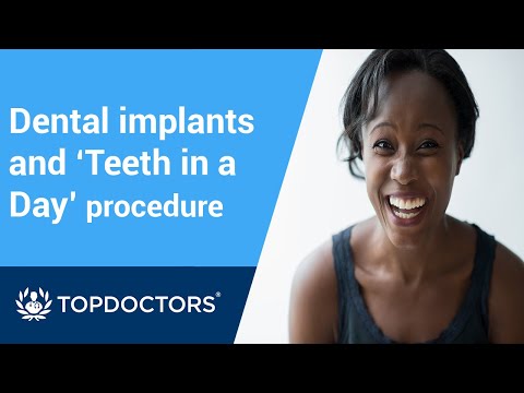 download lagu mp3 mp4 New Teeth Now Implants Cost, download lagu New Teeth Now Implants Cost gratis, unduh video klip New Teeth Now Implants Cost