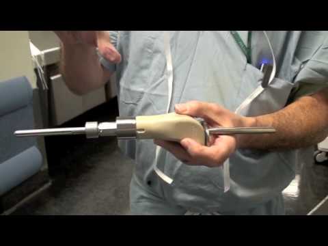 Limb Preservation Surgery