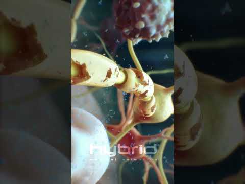 Multiple sclerosis (MS) animation | myelin sheath destruction | medical animation | MS animation