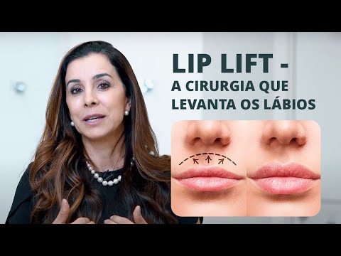 LIP LIFT - A CIRURGIA QUE LEVANTA OS LÁBIOS