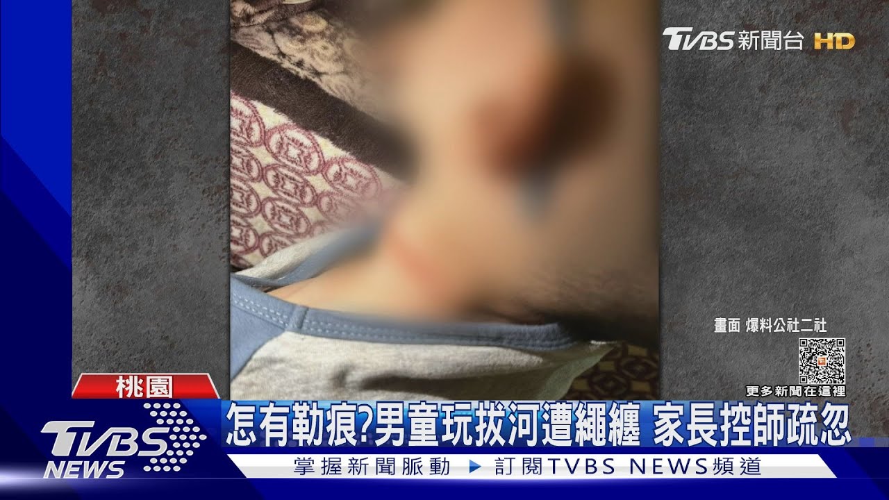 怎有勒痕？男童玩拔河遭繩纏　家長控師疏忽