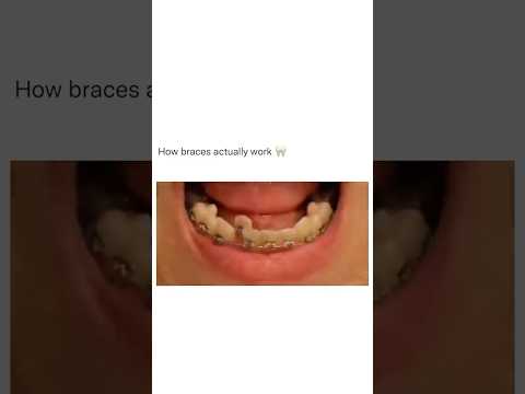 Dentist Reveals Secret That Could Save You 4 Teeth! 🦷😬