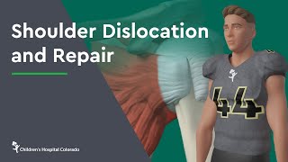 Shoulder Dislocation and Repair