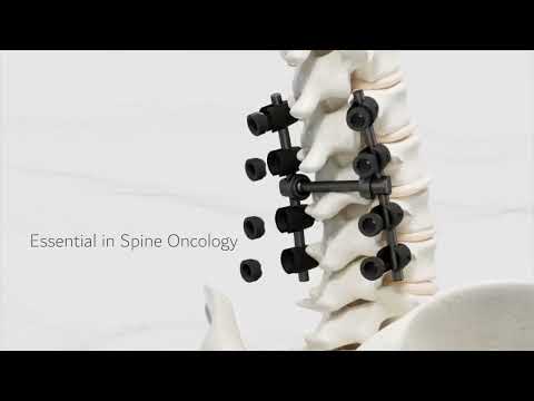 CarboFix Spine Video