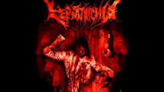 Leptotrichia - Peg Out In Gastric Juice