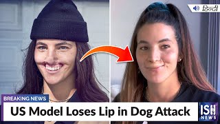 US Model Loses Lip in Dog Attack