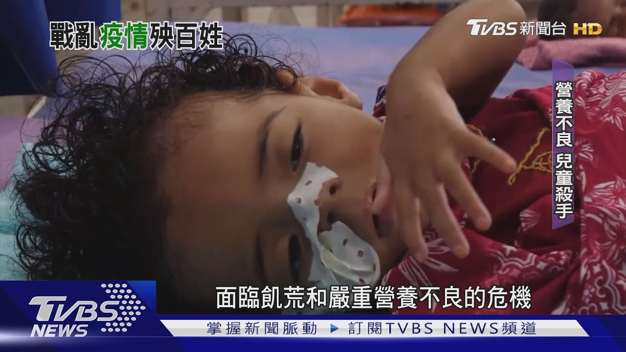 內戰飢荒與疫情 葉門民眾活在危險邊緣