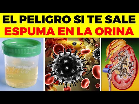 Causas Comunes De La Aparición De Espuma En La Orina y Su Tratamiento