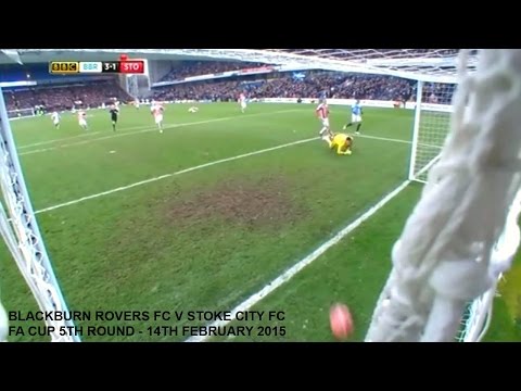 BLACKBURN ROVERS FC V STOKE CITY FC FA CUP 5TH ROUND 2015