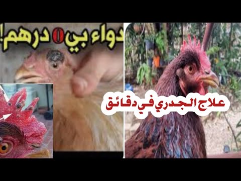 , title : 'افضل علاج طبيعي لمرض  الجدري عند الدجاج 🐓وكيف  تحمي موت دجاجك من هدا المرد الخطير'