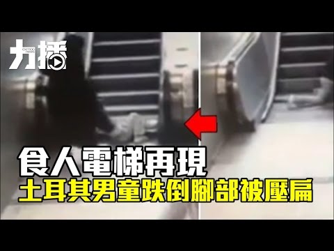 土耳其男童跌倒腳部被壓扁