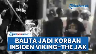 "Di Atas Rivalitas, Kita Tetap Manusia" Ganindra Bimo Bantu Biaya Pengobatan Balita yang Jadi Korban