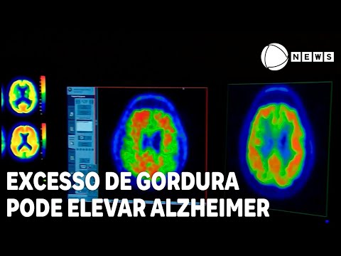 Excesso de gordura abdominal pode elevar chance da Alzheimer