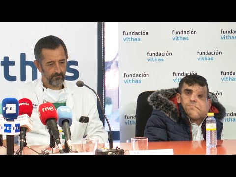 Cavadas extirpa con éxito un tumor gigante en la cara de 13 kilos