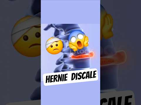 HERNIE DISCALE : Est-ce que tu en as une? #santé #herniediscale #douleur  #conseilssanté #sciatique