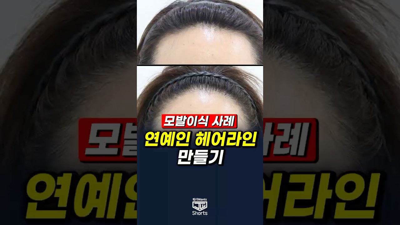 더원츠의원 숏폼