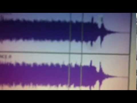 SoundOrchard Fragment - eye strings
