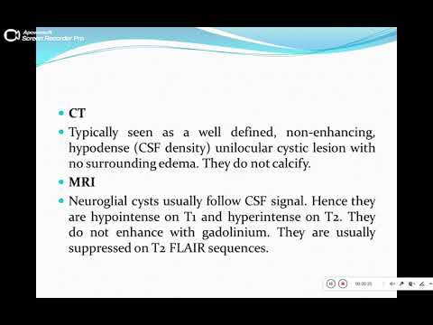 Quiz powerpoint video case 165 - Refresh your knowledge