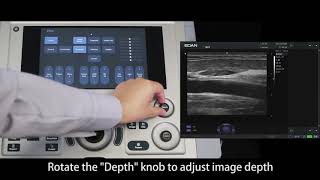 Download lagu Edan AX3 Ultrasound Machine - User /Setup Operation Video mp3
