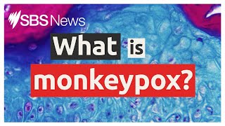 Monkeypox explained: what you need to know about the outbreak | SBS News