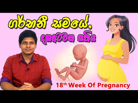 Pregnancy 18th Week | Sinhala Medical Review | අම්මයි බබයි