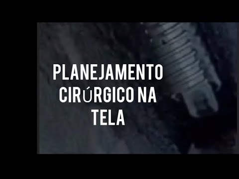 Marcelo Emanoel-34