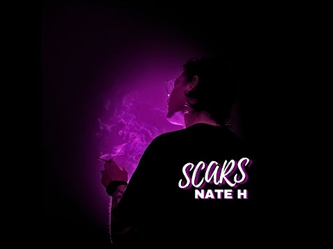 Scars - Nate H
