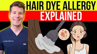 Doctor explains HAIR DYE ALLERGIC REACTION | Causes, symptoms & treatment