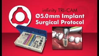 infinity TRI-CAM 5.0mm – 4.3mm PS Implant Surgical Protocol