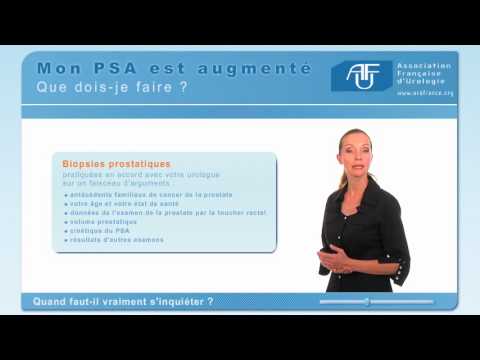 Wo steht die Prostata Video als Frau die Prostata massiert