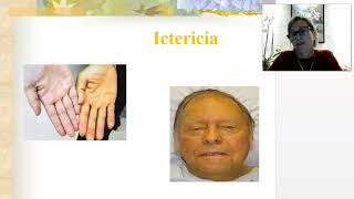 Situación clínica 4 parte A ExFisico MPNA 2021