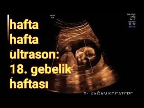 18. gebelik haftasında anne karnındaki bebek - Hareketler hangi haftada başlar ve hissedilir?