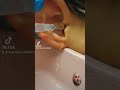 Earwax Removal What Did I Just Remove Is It A Large Piece Of Wax Or Sometype Of Animal
