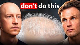 The Biggest Hair Transplant Mistake Men Keep Making