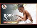 HAIRY TAIL BOY OF PUNJAB INDIA