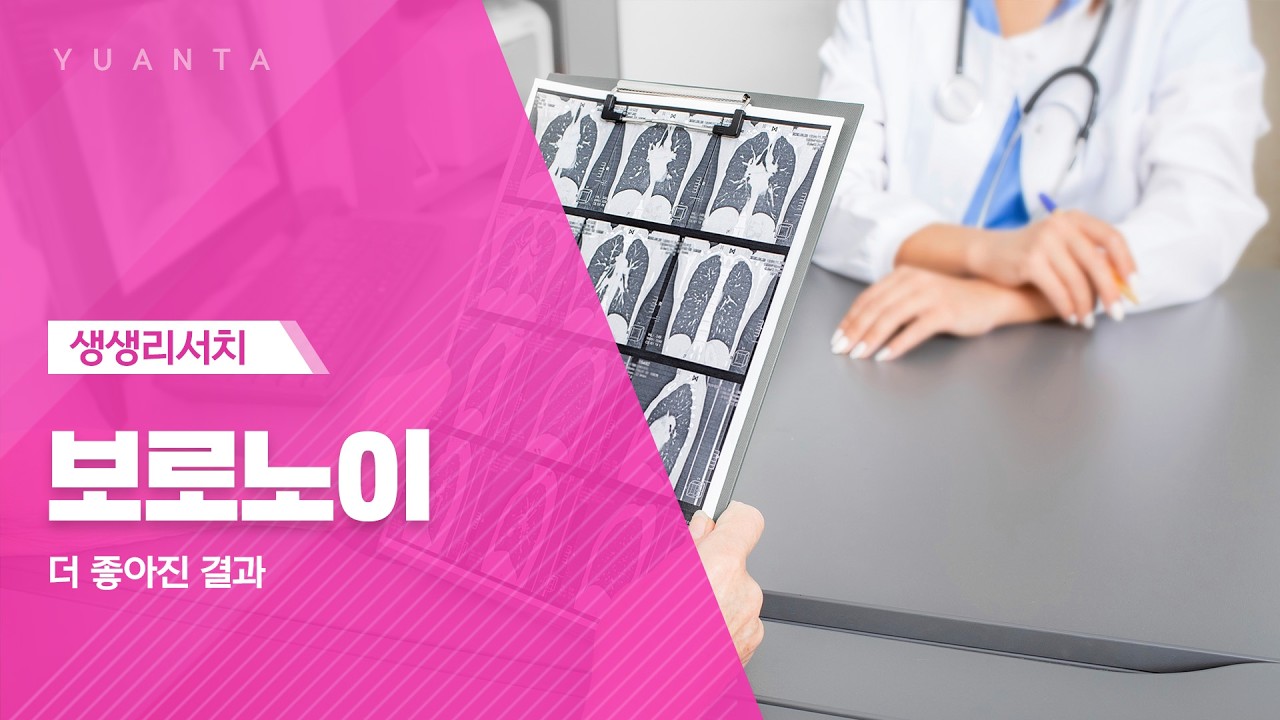 보로노이 : 더 좋아진 결과 - 하현수 연구원