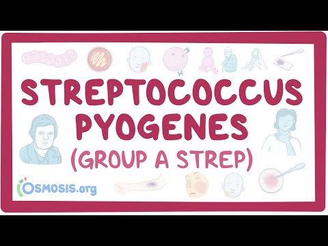 Streptococcus pyogenes (Group A Strep) - causes, symptoms, diagnosis, treatment, pathology