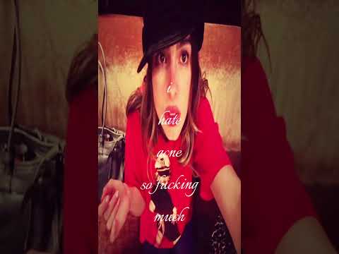 #aesthetic #teenagers #acne #Addisonrae