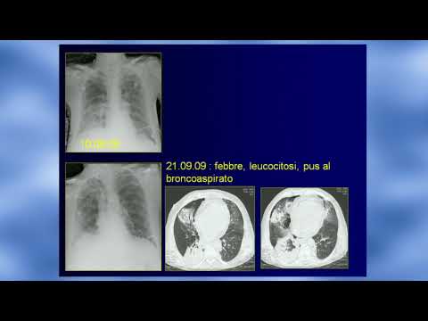 Radiografie della colonna cervicale che mostra Il mal di schiena con quadrante in alto a sinistra quando si guida