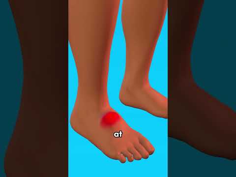 How To Treat A Scorpion Sting ♏