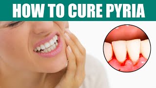 How to Deal with Pyorrhea: All You Need to Cure Pyria