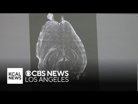 Ucla Brain Mapping Research